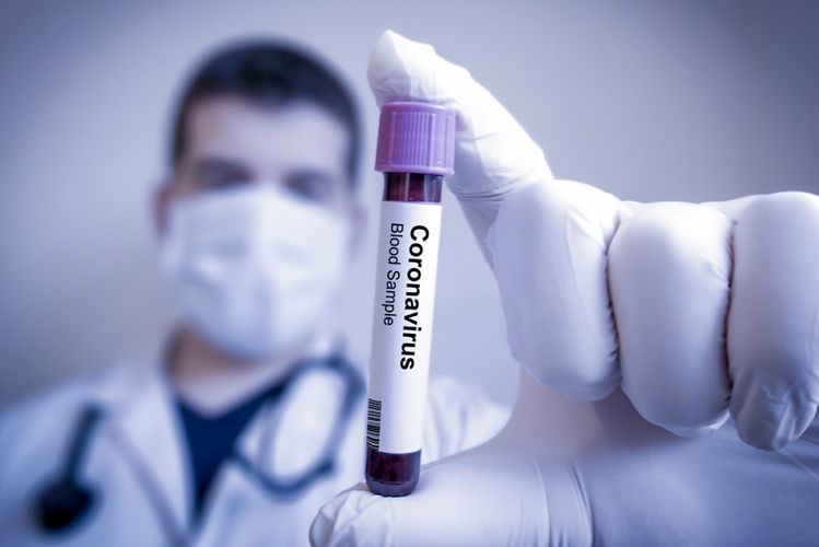 DİQQƏT: Koronavirus bu temperaturda daha da aktivləşir 
