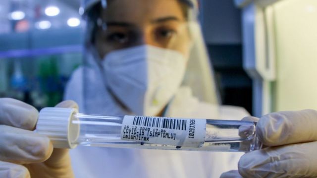 Azərbaycanda daha 69 nəfər koronavirusa yoluxub, 4 nəfər ölüb

 