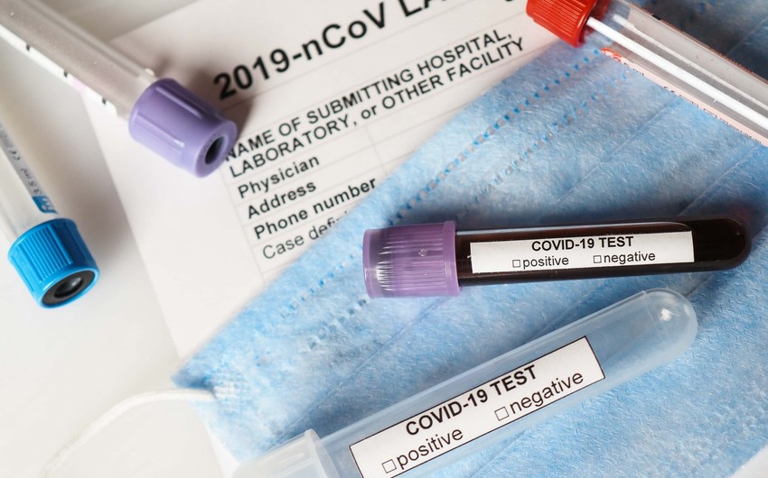Koronavirusa yoluxan və vaksinasiya olunanların sayı açıqlanıb

 